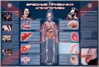 Электрифицированный стенд "Вредные привычки: алкоголизм" - «globural.ru» - Миасс