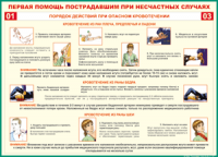 Таблица Порядок действий при опасном кровотечении 1000*1400 винил - «globural.ru» - Миасс